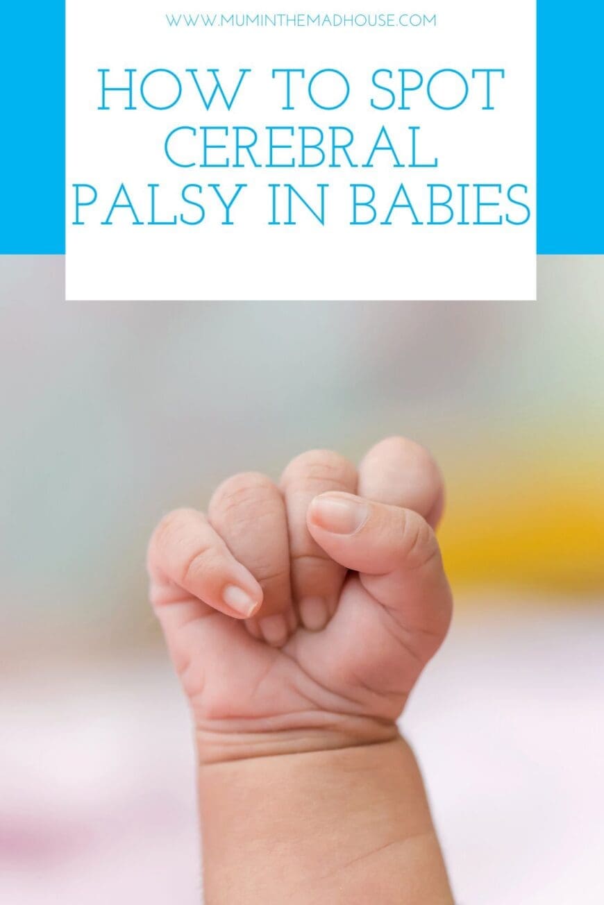 How to Spot Cerebral Palsy in Babies